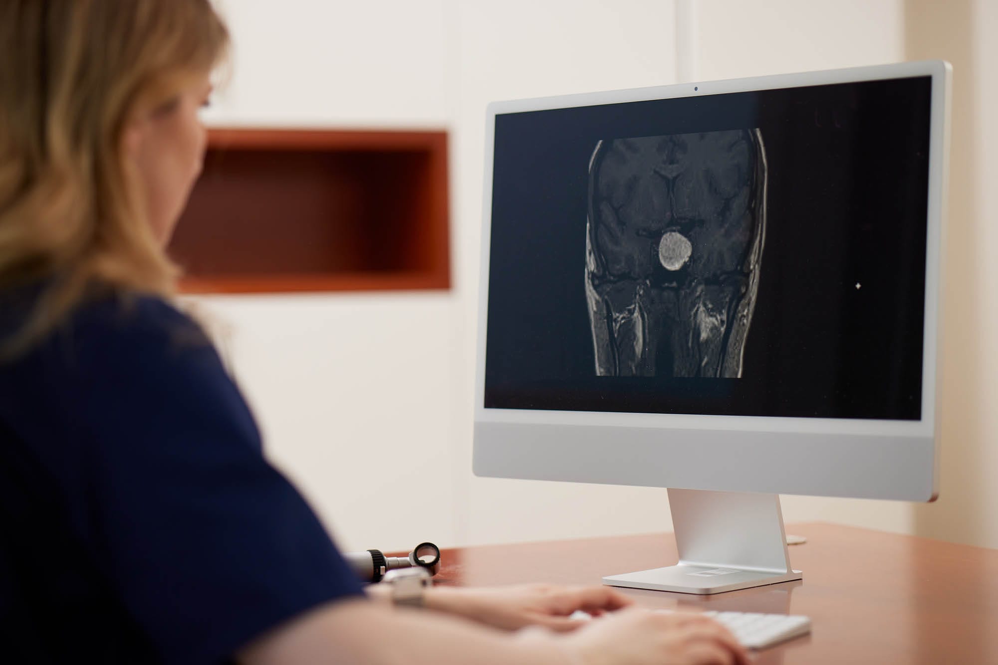 Eine Ärztin wertet eine MRT-Aufnahme aus, auf der ein Prolaktinom zu sehen ist.