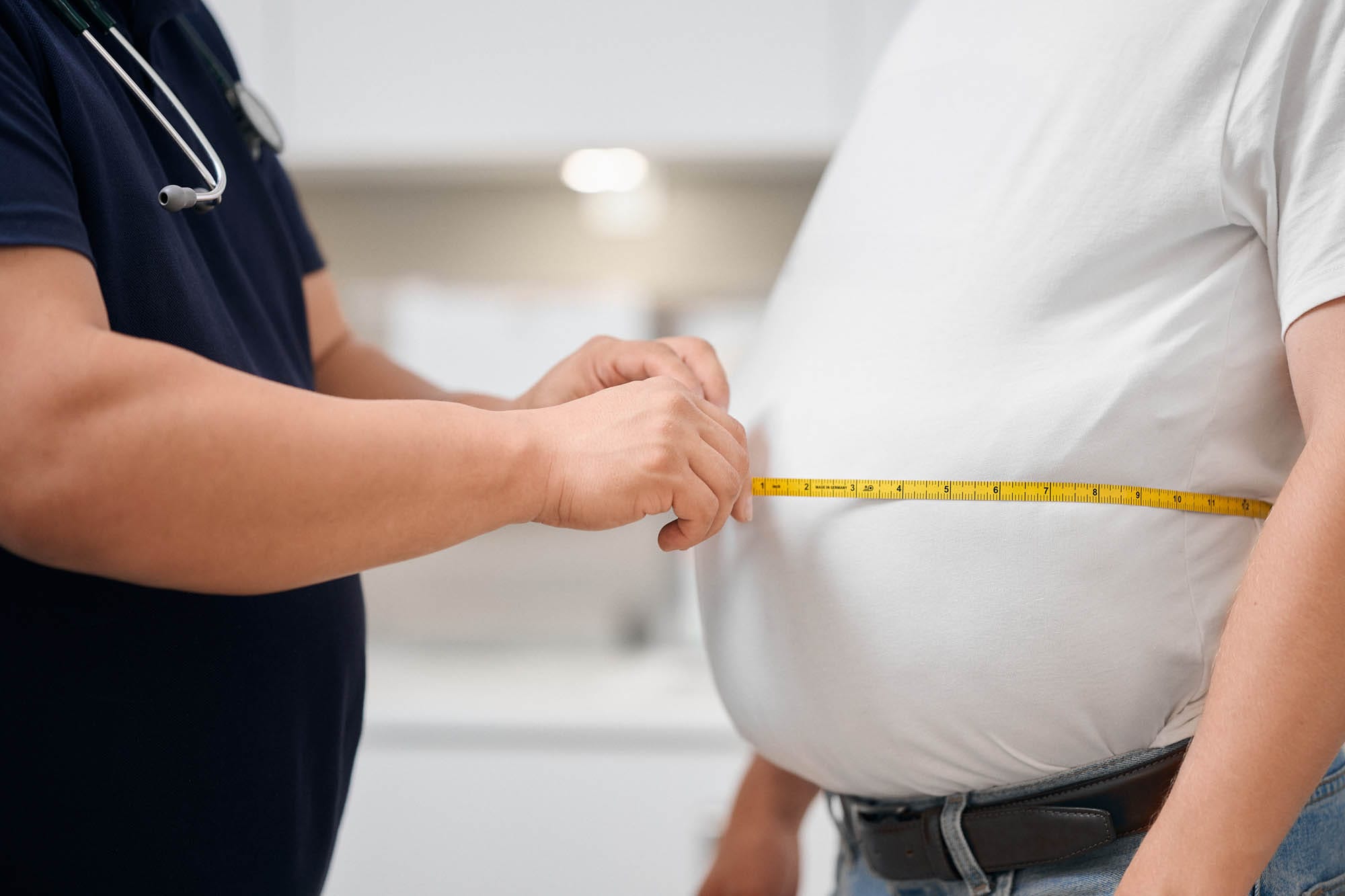 Mit einem Maßband wird der Bauchumfang gemessen.