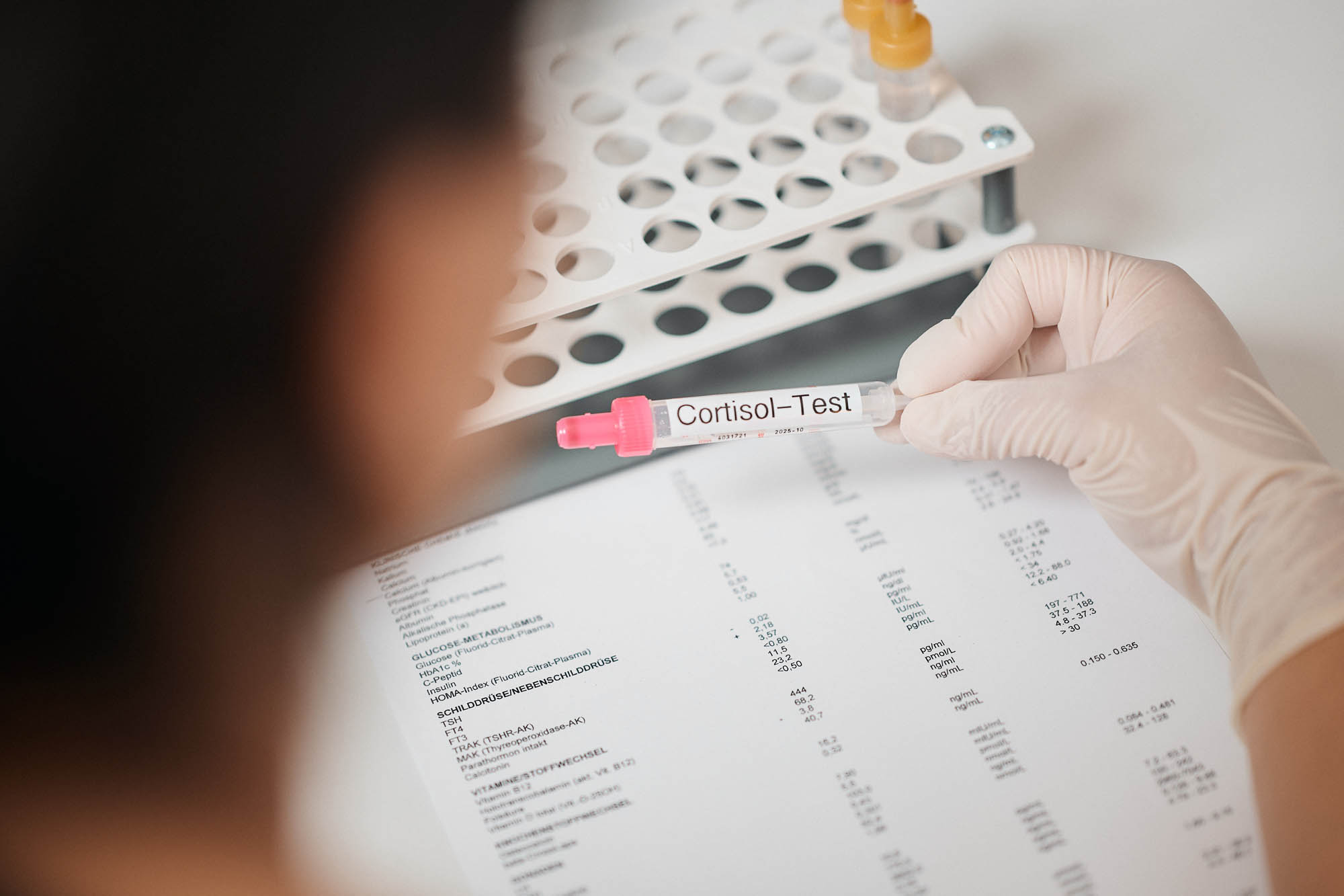 8_Cortisol_Test Das Teströhrchen eines Cortisol-Tests